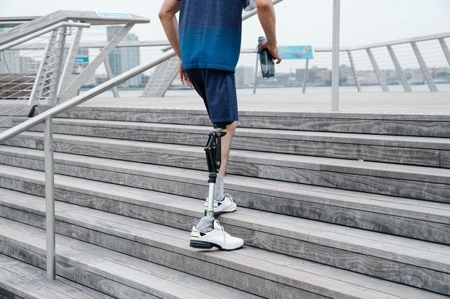person with a prosthetic leg walking up steps